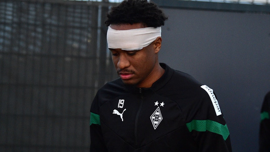 Nathan N'Goumou von Borussia Mönchengladbach musste wegen eines Hagelkorns am Auge am Montag (9. Januar 2023) mit auffälligem Verband trainieren.